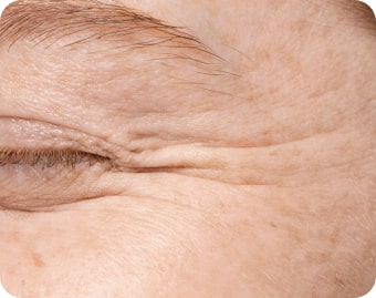 Fine Lines